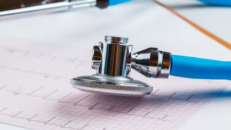 blue-stethoscope-resting-on-printed-ecg-chart